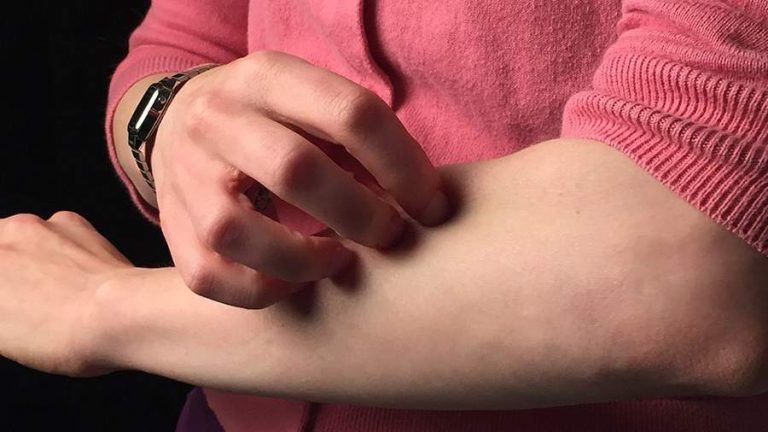 Пациенты с болезнями кожи указали на проблемы с выдачей лекарств в ряде регионов